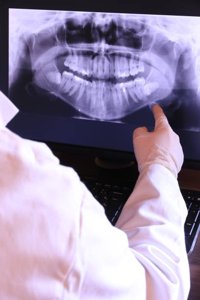 Best Emergency Denture Repair in Ferry Pass, FL