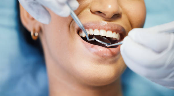 Best Walk-In Emergency Dental Services in Ferry Pass, FL